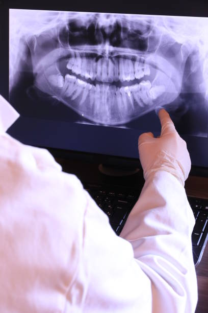 Best Emergency Care for Gum Disease in Rapid Valley, SD